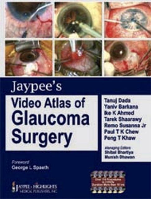 Jaypee's Video Atlas of Glaucoma Surgery, Mixed media product Book