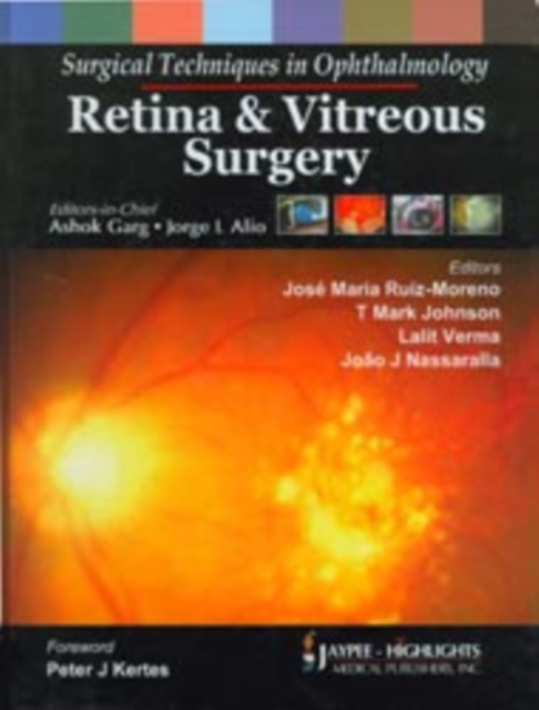 Surgical Techniques in Ophthalmology: Retina and Vitreous Surgery, Hardback Book
