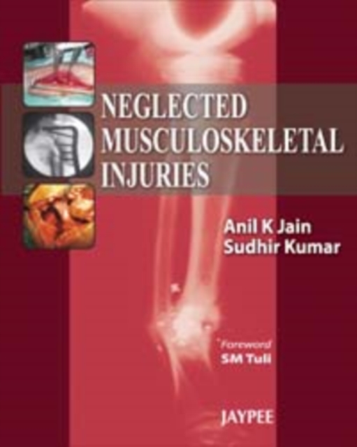 Neglected Musculoskeletal Injuries, Hardback Book