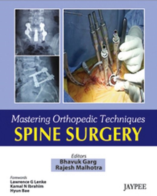 Mastering Orthopaedic Techniques Spine Surgery, Hardback Book
