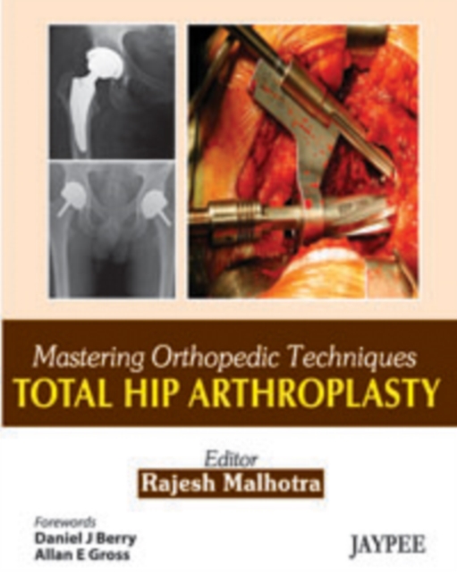 Mastering Orthopedic Techniques: Total Hip Arthroplasty, Hardback Book