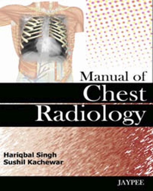 Manual of Chest Radiology, Hardback Book