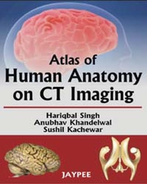 Atlas of Human Anatomy on CT Imaging, Paperback / softback Book