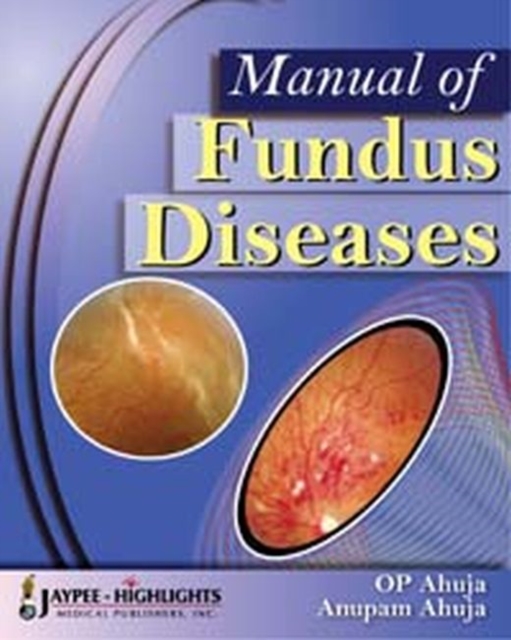 Manual of Fundus Diseases, Hardback Book