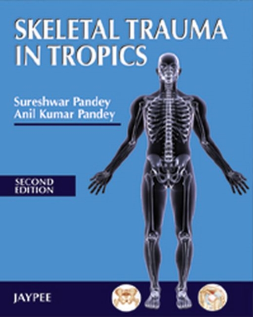 Skeletal Trauma in Tropics, Paperback / softback Book