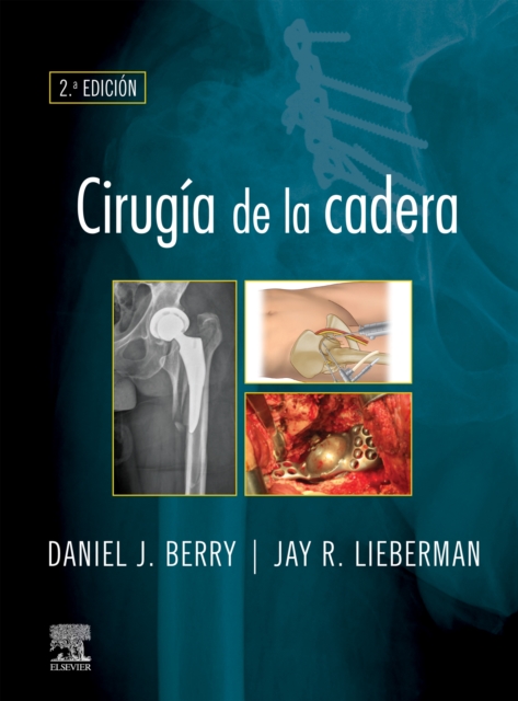Cirugia de la cadera, EPUB eBook