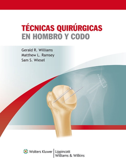 Tecnicas quirurgicas en hombro y codo, Hardback Book