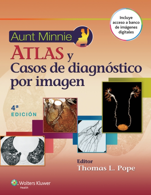 Aunt Minnie. Atlas y casos de diagnostico por imagen, Paperback / softback Book