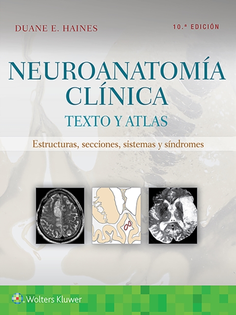 Neuroanatomia clinica : Texto y atlas, Paperback / softback Book