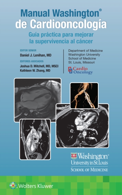 Manual Washington de Cardiooncologia : Guia practica para mejorar la supervivencia al cancer, Paperback / softback Book