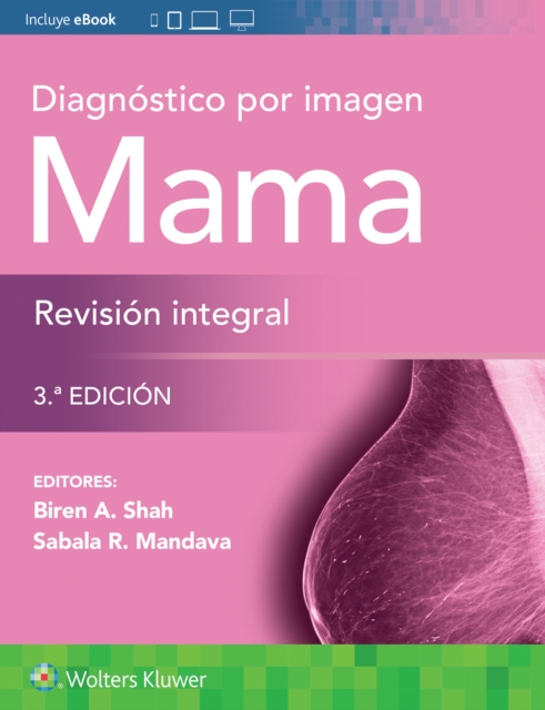 Diagnostico por imagen. Mama. Revision integral, Paperback / softback Book