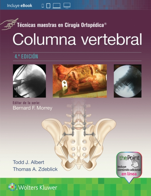 Tecnicas maestras en Cirugia Ortopedica. Columna vertebral, Paperback / softback Book