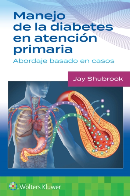 Manejo de la diabetes en Atencion primaria. Abordaje basado en casos, Paperback / softback Book