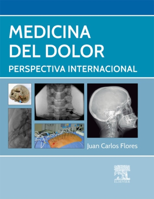 Medicina del dolor : Perspectiva internacional, EPUB eBook