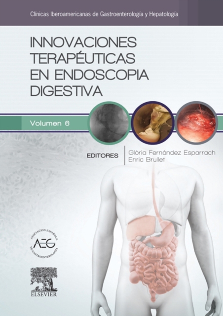 Innovaciones terapeuticas en endoscopia digestiva : Clinicas Iberoamericanas de Gastroenterologia y Hepatologia vol. 6, EPUB eBook