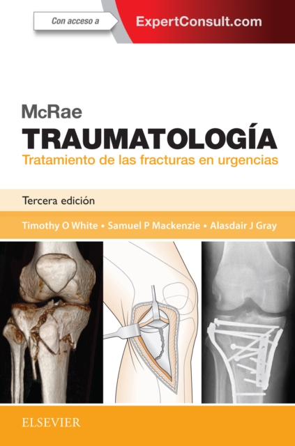 McRae. Traumatologia. Tratamiento de las fracturas en urgencias, EPUB eBook