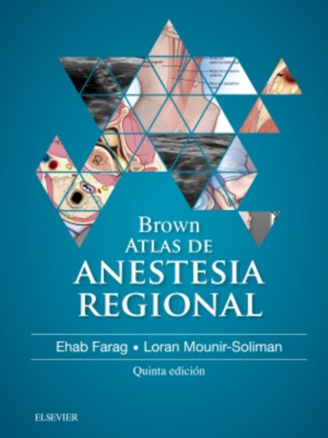 Brown. Atlas de Anestesia Regional, EPUB eBook