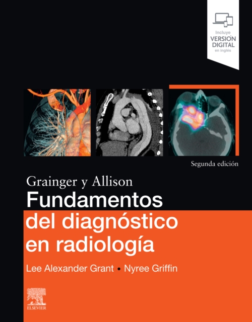 Fundamentos del diagnostico en radiologia, EPUB eBook