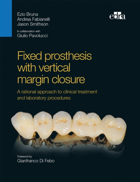 Fixed prosthesis with vertical margin closure : Integration between function and aesthetics, EPUB eBook