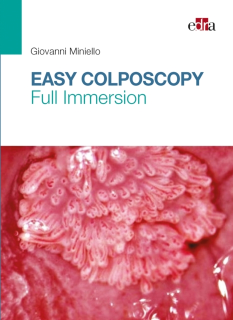 Easy Colposcopy, EPUB eBook