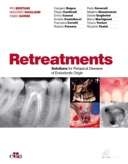 Retreatments : Solutions for apical diseases of endodontic origin, EPUB eBook