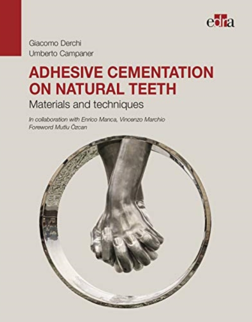 Adhesive cementation on natural teeth - Materials and techniques, Hardback Book