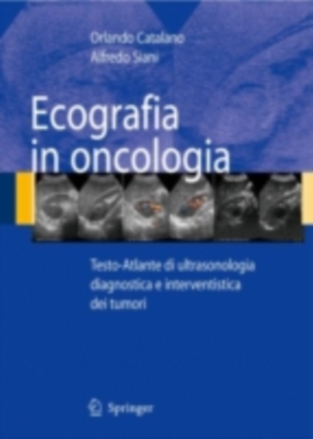 Ecografia in oncologia : Testo-Atlante di ultrasonologia diagnostica e interventistica dei tumori, PDF eBook