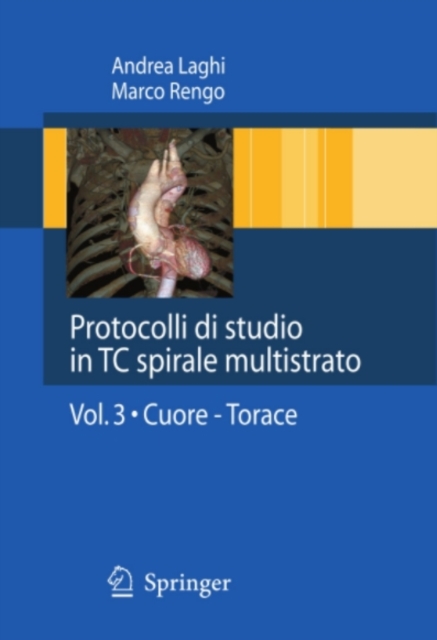 Protocolli di studio in TC spirale multistrato : Volume 3: Cuore - Torace, PDF eBook