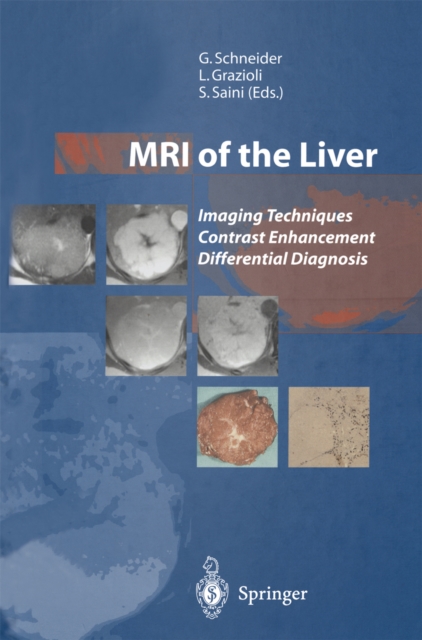MRI of the Liver : Imaging Techniques Contrast Enhancement Differential Diagnosis, PDF eBook