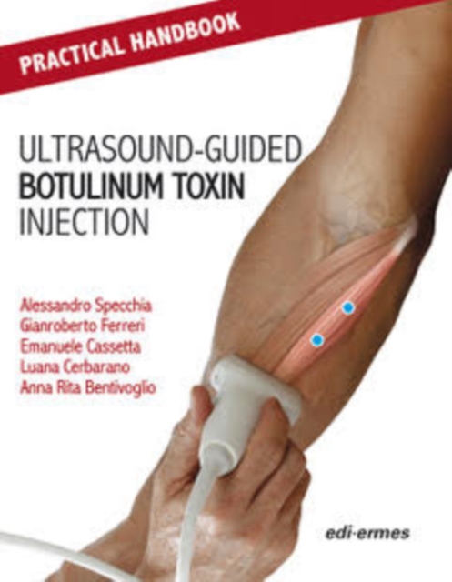 Practical Handbook for Ultrasound-guided Botulinum Toxin Injection, Paperback / softback Book