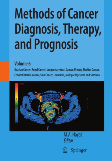 Methods of Cancer Diagnosis, Therapy, and Prognosis : Ovarian Cancer, Renal Cancer, Urogenitary tract Cancer, Urinary Bladder Cancer, Cervical Uterine Cancer, Skin Cancer, Leukemia, Multiple Myeloma a, PDF eBook