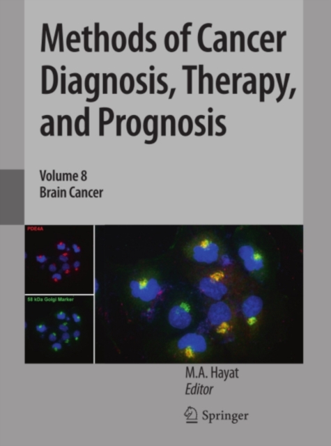 Methods of Cancer Diagnosis, Therapy, and Prognosis : Brain Cancer, PDF eBook