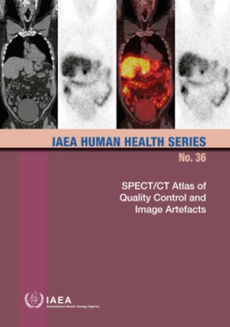 SPECT/CT Atlas of Quality Control and Image Artefacts, Paperback / softback Book