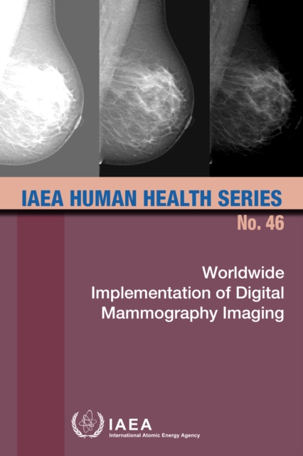 Worldwide Implementation of Digital Mammography Imaging, EPUB eBook