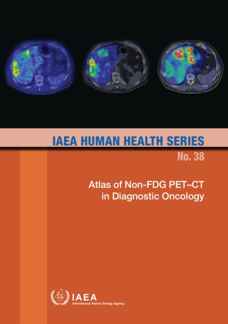 Atlas of Non-FDG PET-CT in Diagnostic Oncology, EPUB eBook