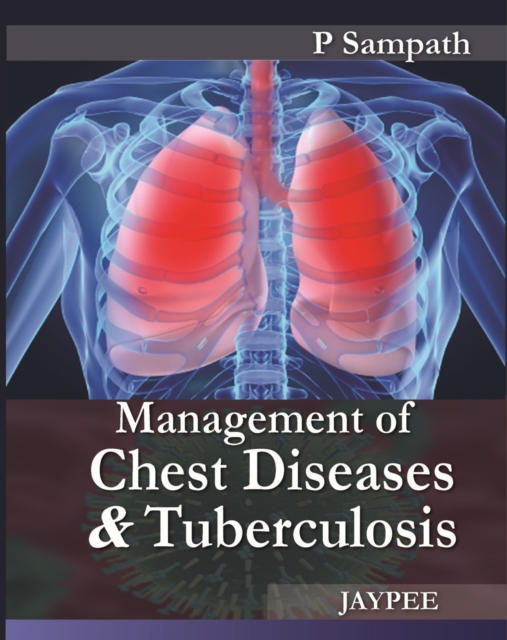 Management of Chest Diseases and Tuberculosis, Paperback / softback Book