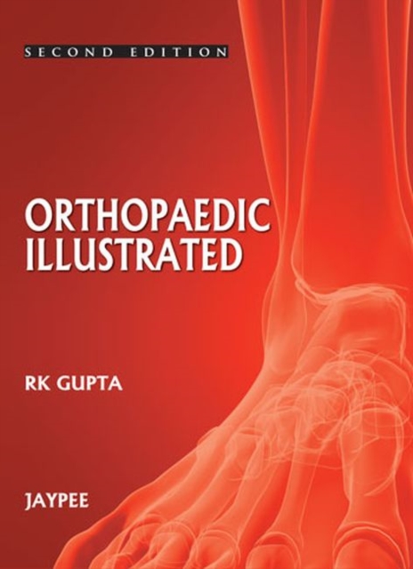 Orthopedics Illustrated, Paperback / softback Book