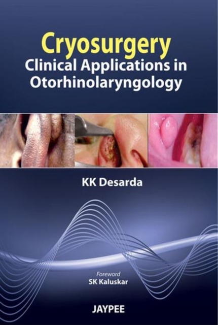 Cryosurgery : Clinical Applications in Otorhinolaryngology, Paperback / softback Book