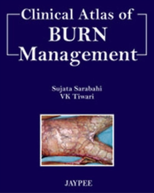 Clinical Atlas of Burn Managment, Hardback Book