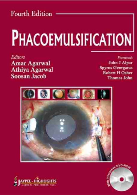 Phacoemulsification, Fourth Edition, Hardback Book