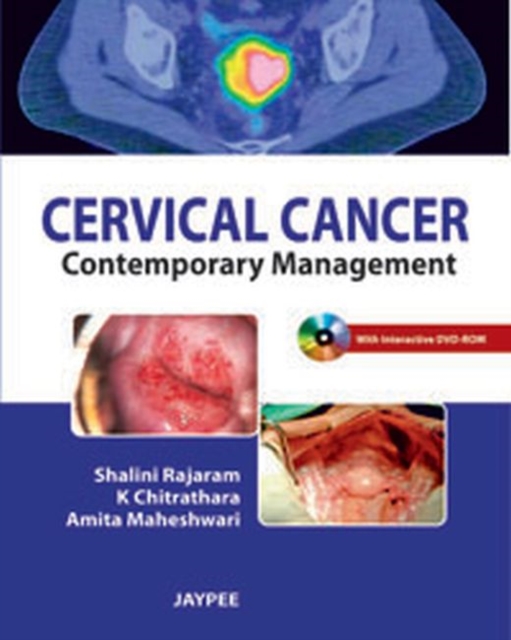 Cervical Cancer : Contemporary Management, Paperback / softback Book