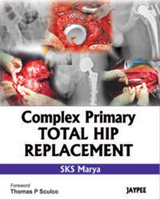 Complex Primary Total Hip Replacement, Hardback Book