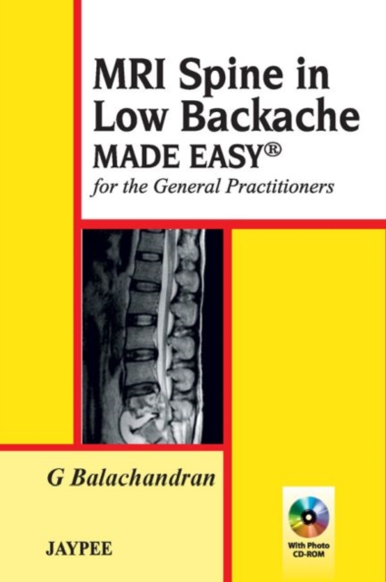 MRI Spine in Low Backache Made Easy, Paperback / softback Book