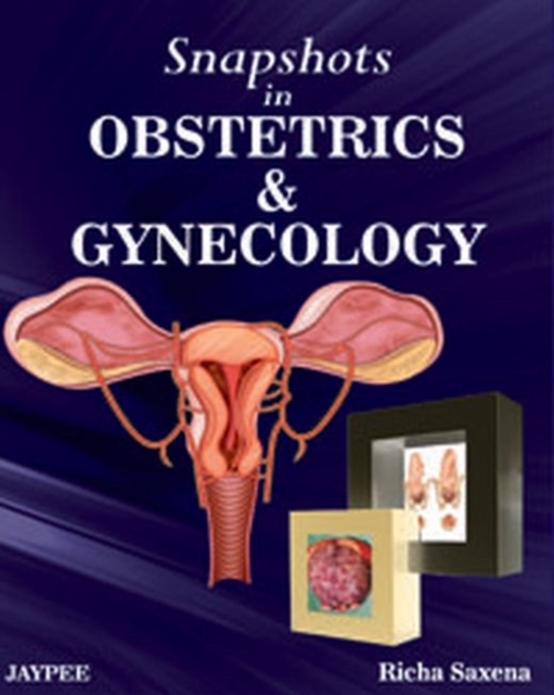 Snapshots in Obstetrics and Gynaecology, Paperback / softback Book