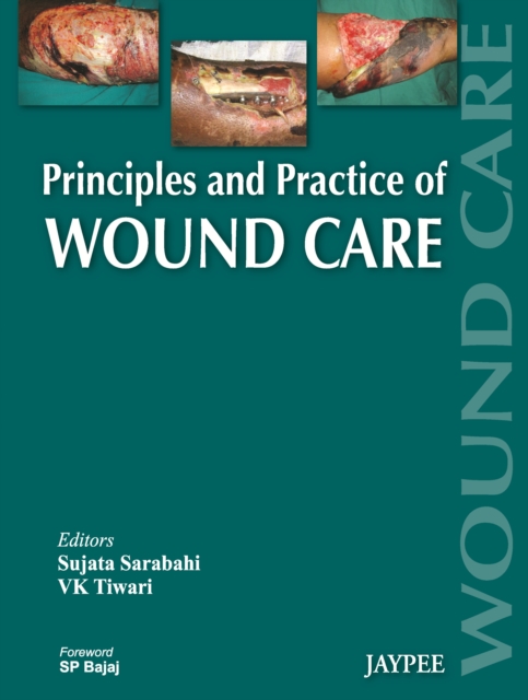 Principles and Practice Of Wound Care, Hardback Book