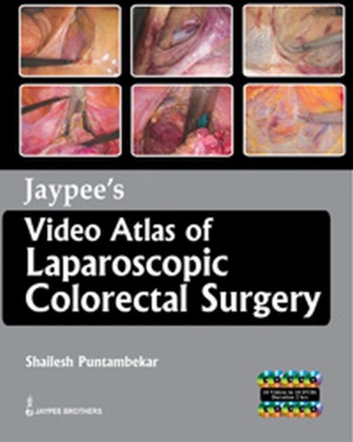 Jaypee's Video Atlas of  Laparoscopic Colorectal Surgery, Mixed media product Book