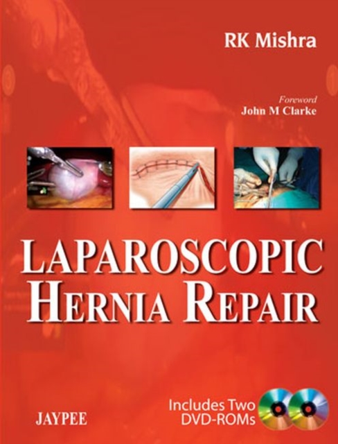 Laparoscopic Hernia Repair, Hardback Book