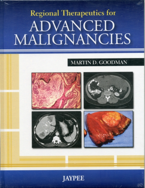 Regional Therapeutics for Advanced Malignancies, Hardback Book