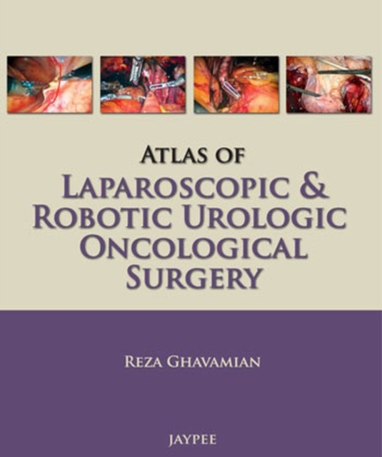 Atlas of Laparoscopic and Robotic Urologic Oncological Surgery, Paperback / softback Book