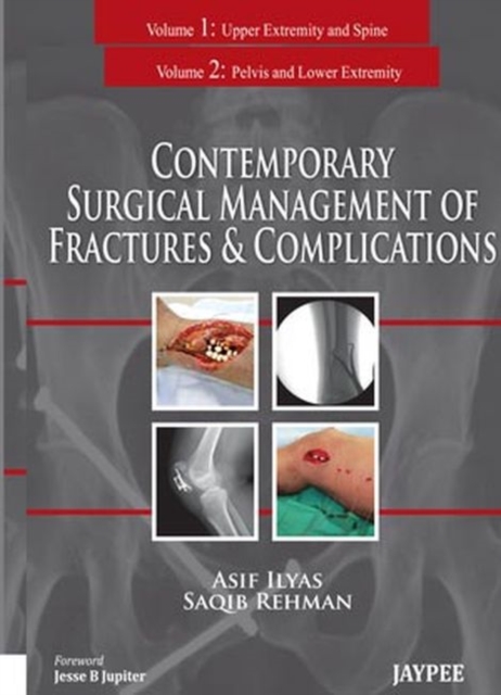 Contemporary Surgical Management of Fractures and Complications, Hardback Book